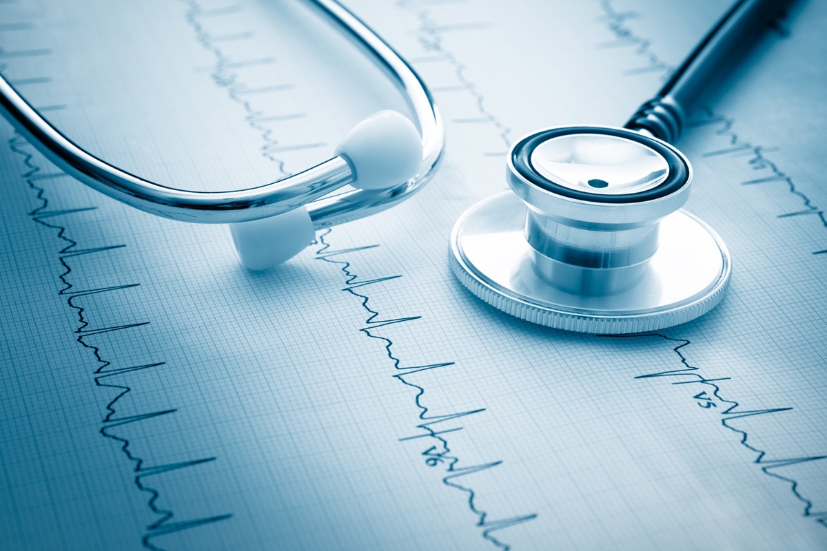 A stethoscope and a heartbeat symbol on a paper, representing medical examination and monitoring.